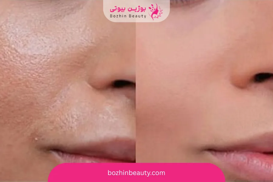 نکات مهم برای افزایش ماندگاری کرم پودر