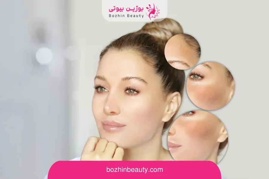 باریک‌تر نشان دادن برخی بخش‌های صورت